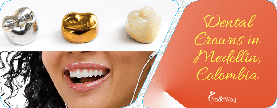 Dental Crowns in Medellin, Colombia